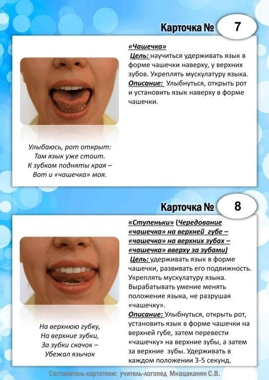 Пластика уздечек языка, верхней и нижней губы