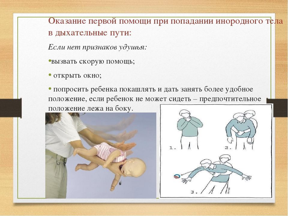 Инородные тела помощь. Оказание помощи при попадании инородного тела. Оказание первой помощи при попадании инородного тела в дыхательные. Оказание 1 помощи при попадании инородных тел в дыхательные пути. Приемы оказания первой помощи при попадании инородных тел.