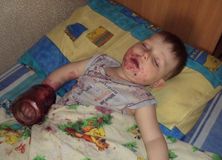 Передозировка.