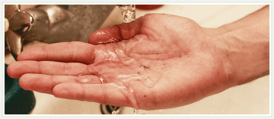 Влияние железа на воду. Заболевания переносимые водой. Чем опасен Марганец в воде для человека. Сморщенная рука из за воды.